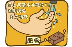 不可小瞧的“狂犬病”