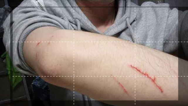 舍友养猫，自己的床单被猫尿了，网友晒出自己被猫抓的印记