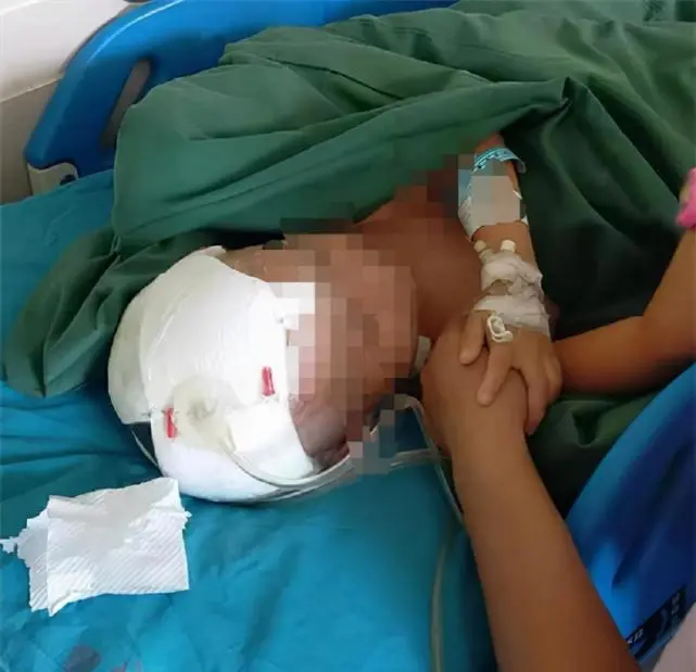 2021年山东两只烈性犬撕咬4岁女童致重伤，两周后又将6岁男童咬伤