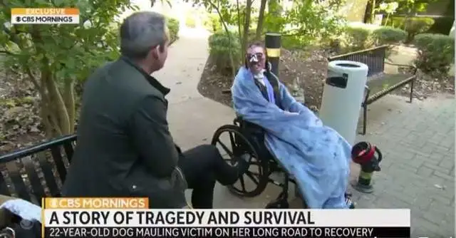 美国女子遛狗时遭2只狗攻击，全身被咬800次脸部被撕掉！