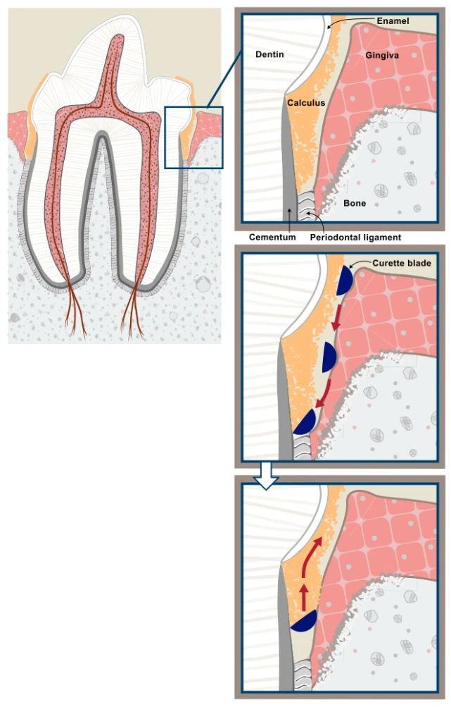 洗个牙而已，宠物为什么要全麻？