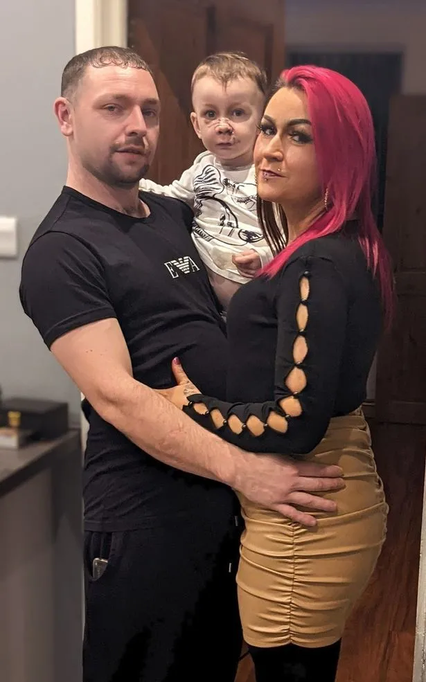 英国男童被自家斗牛犬咬穿鼻子，母亲怕狗被处死还想给它找个新家