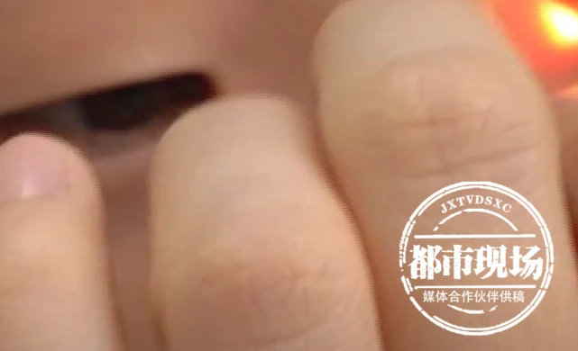 12岁女孩右眼失明，眼科医生：和她家里养的宠物有关