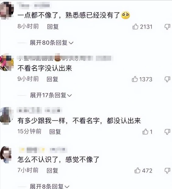 婚后43岁陈乔恩晒照大变样，大小脸明显烤瓷牙抢镜，网友：不认识